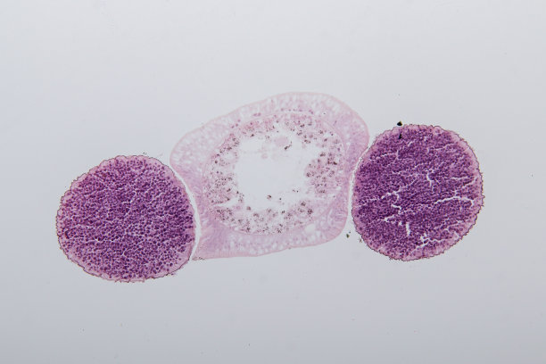 cnidaria