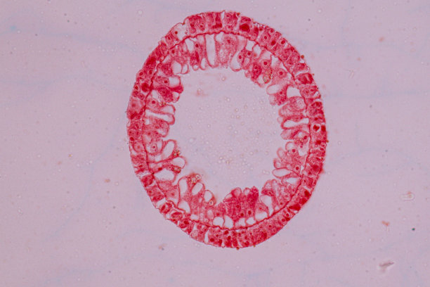 cnidaria