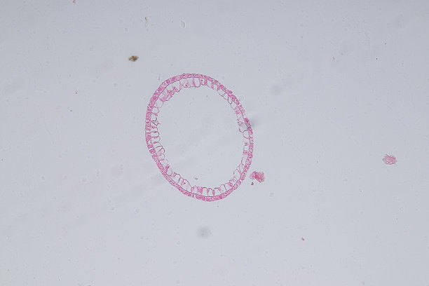 cnidaria