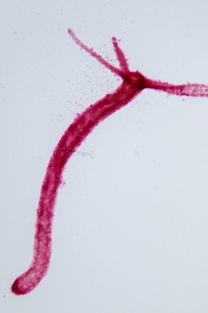 cnidaria