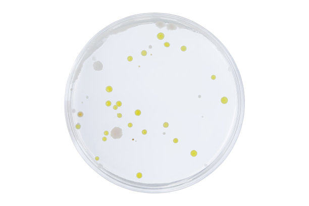 bacteria