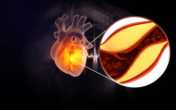 cholesterol