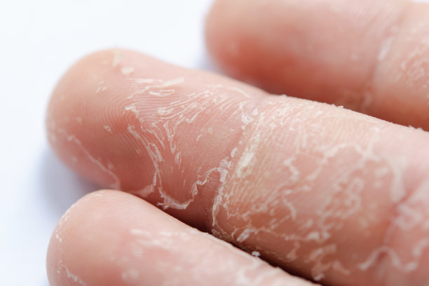 fingers