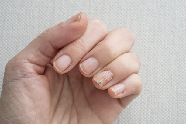nails