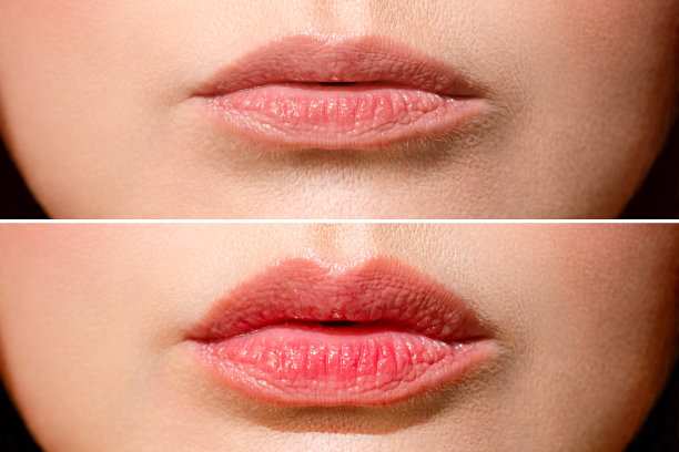 mouth