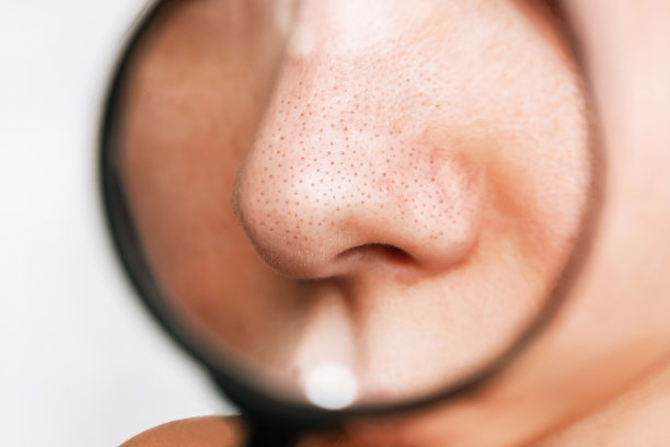 nose