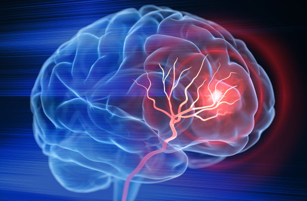 stroke