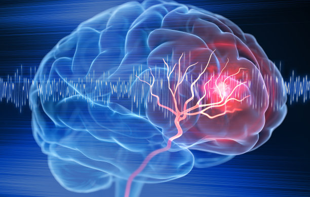 stroke