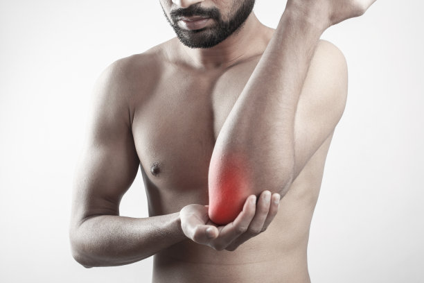 arthritis