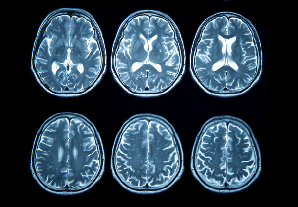 mri