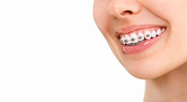 brace