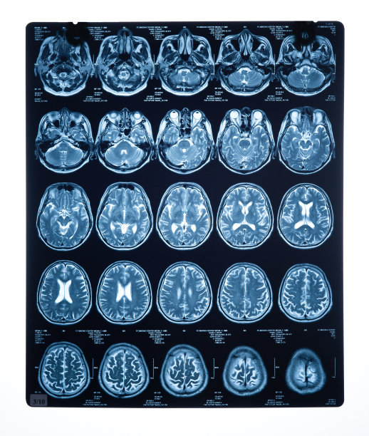 mri