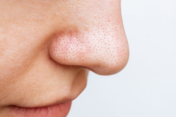 nose