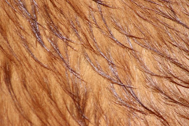 hairs