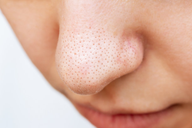 nose