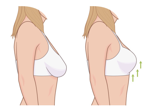 chest