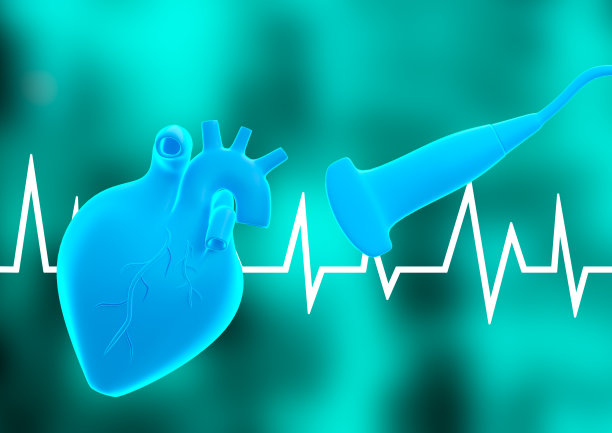 ecg