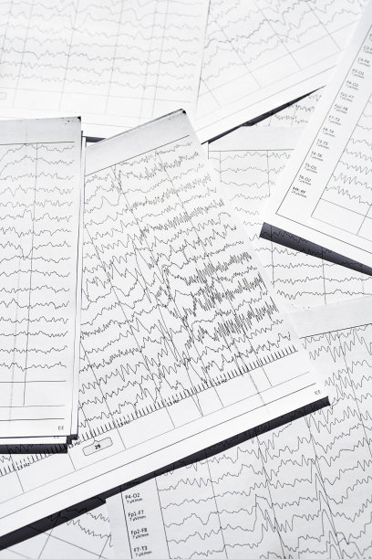 eeg