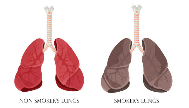 smoking