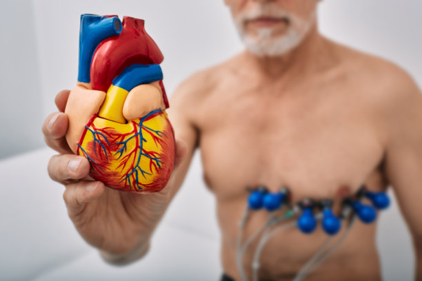 ekg