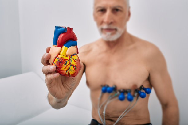 ecg