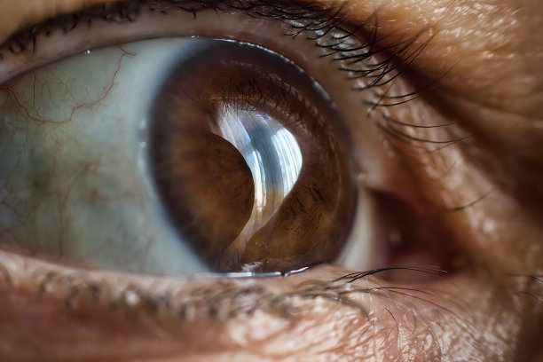 retina