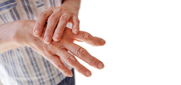 arthritis