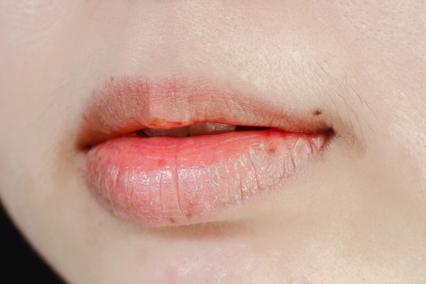 lip