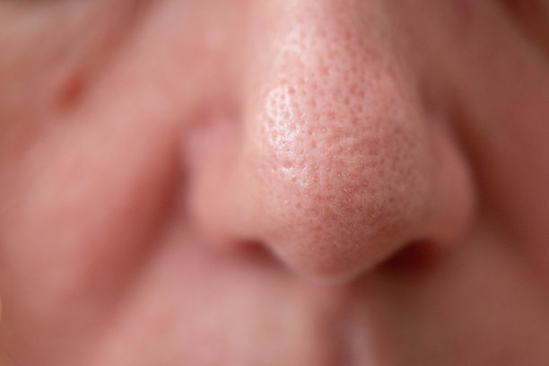 pores
