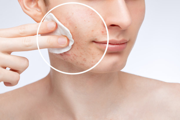 pores