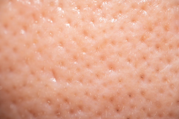 pores