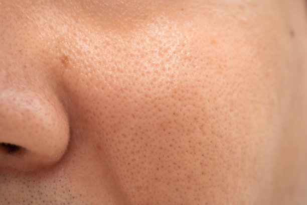 pores