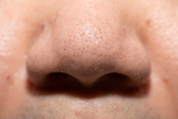 pores