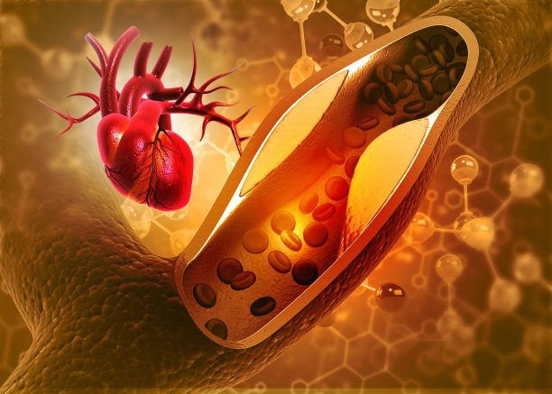 cholesterol