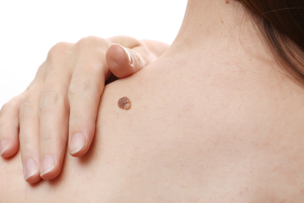shoulder