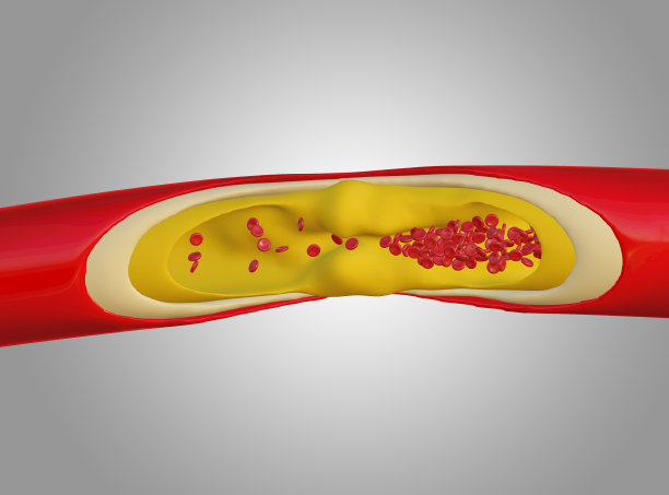 cholesterol