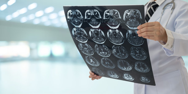 mri