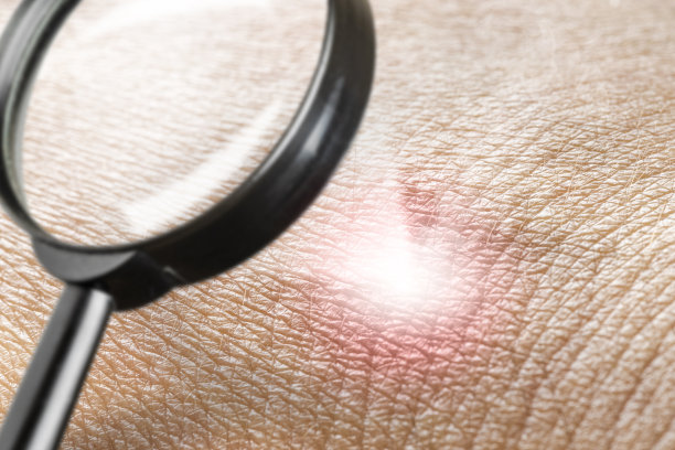 皮肤癌,皮肤状况,皮肤病学