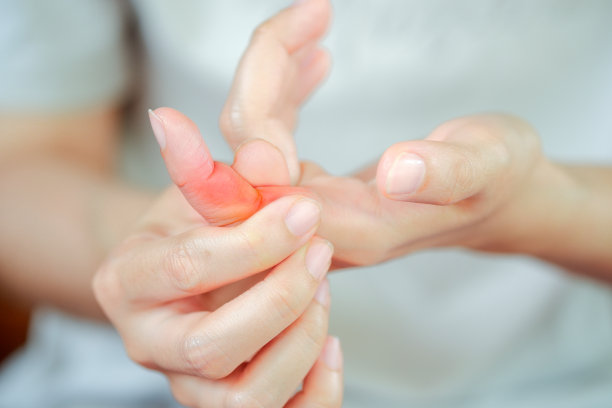 arthritis