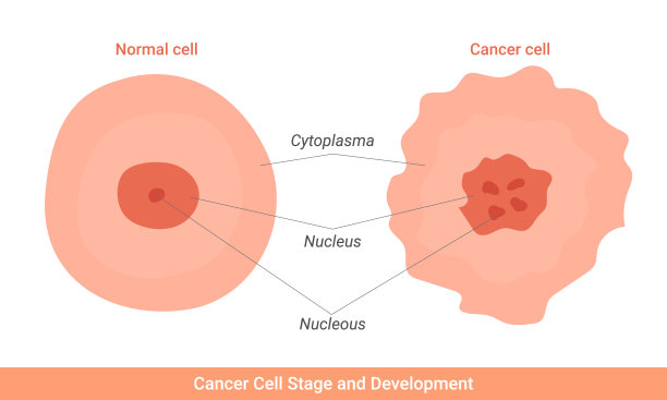 cancer
