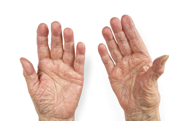 wrinkles