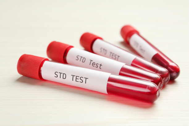 std