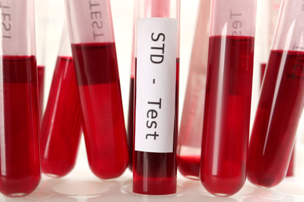 std
