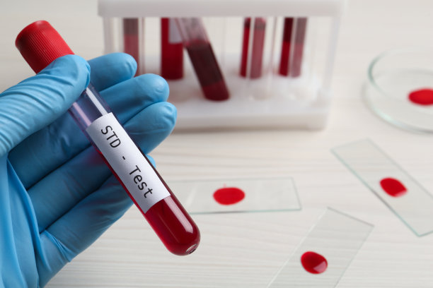 std