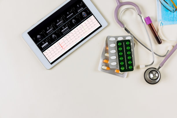 ekg