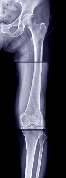 tibia