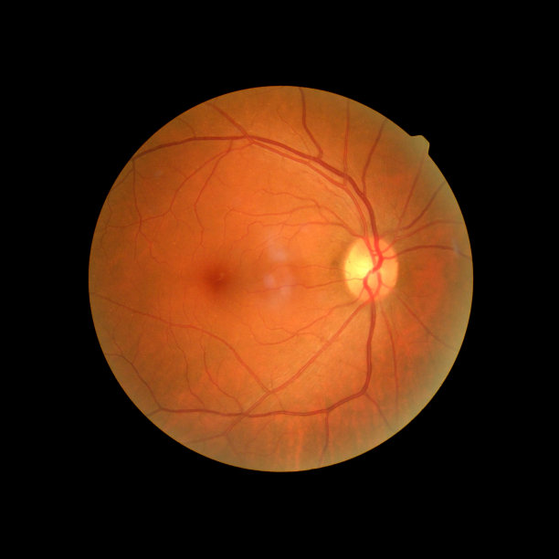 retina