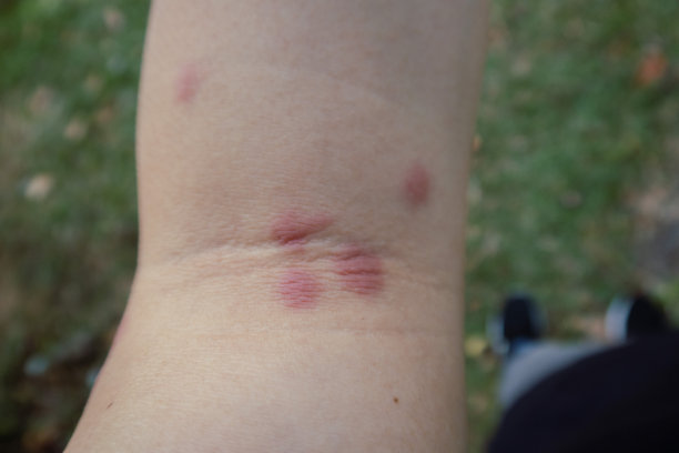 mosquito