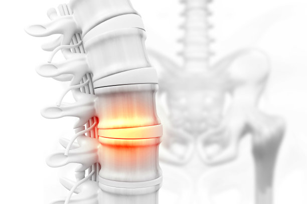 arthritis