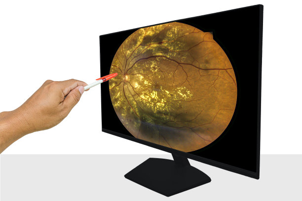 retina